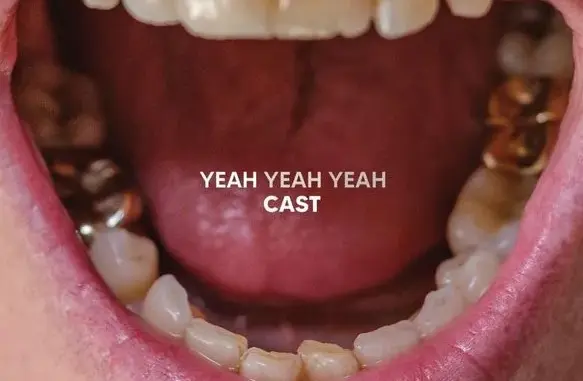 Cast – Yeah Yeah Yeah (Album)