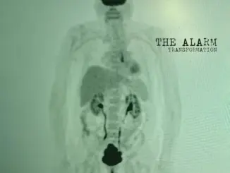 The Alarm – Live Today