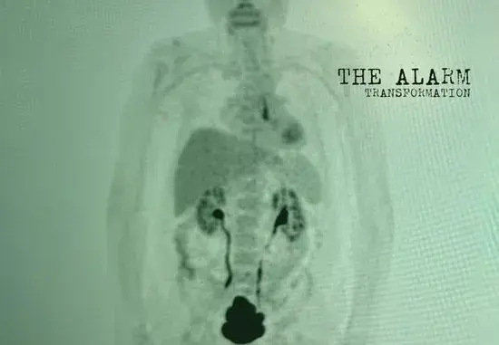 The Alarm – Live Today